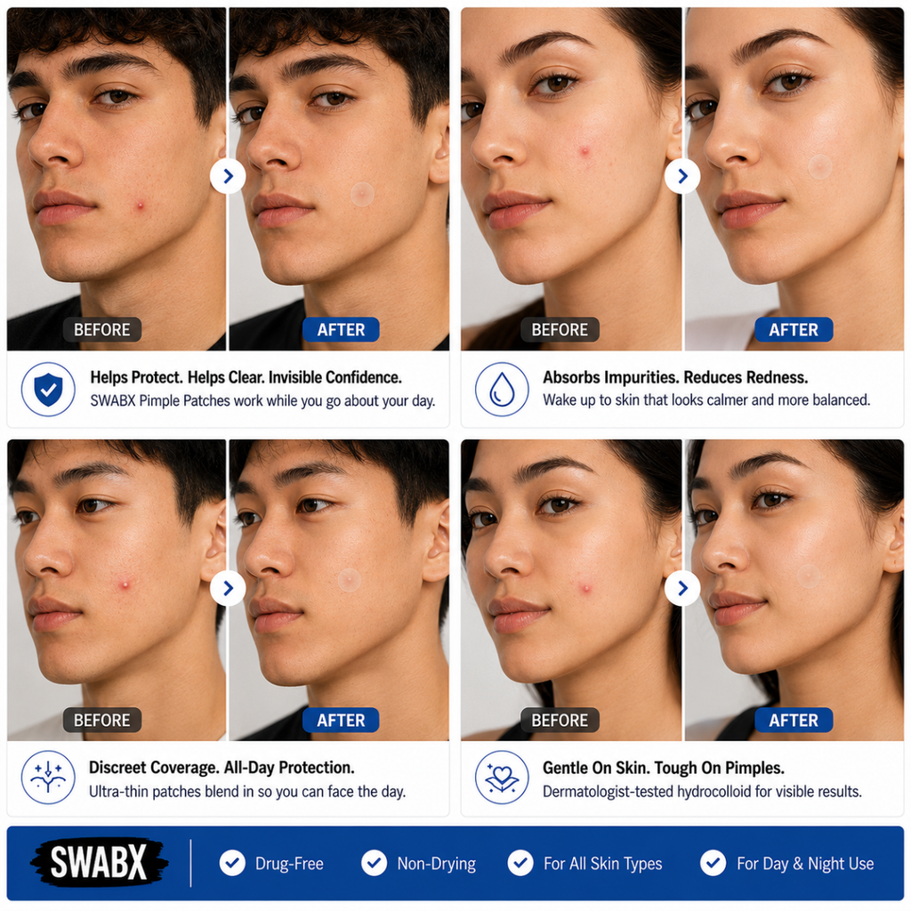 Swabx Acne Pimple Patches